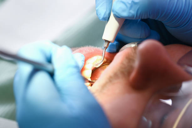 Best Emergency Dental Care for Broken or Chipped Teeth in Deerfield, WI