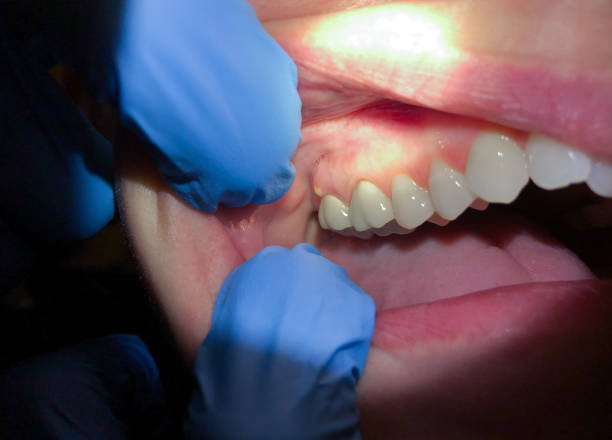 Best Pediatric Emergency Dentist in Deerfield, WI
